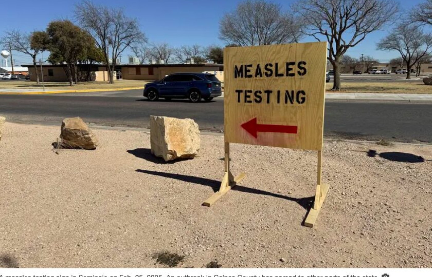 A second Texas child has died from measles